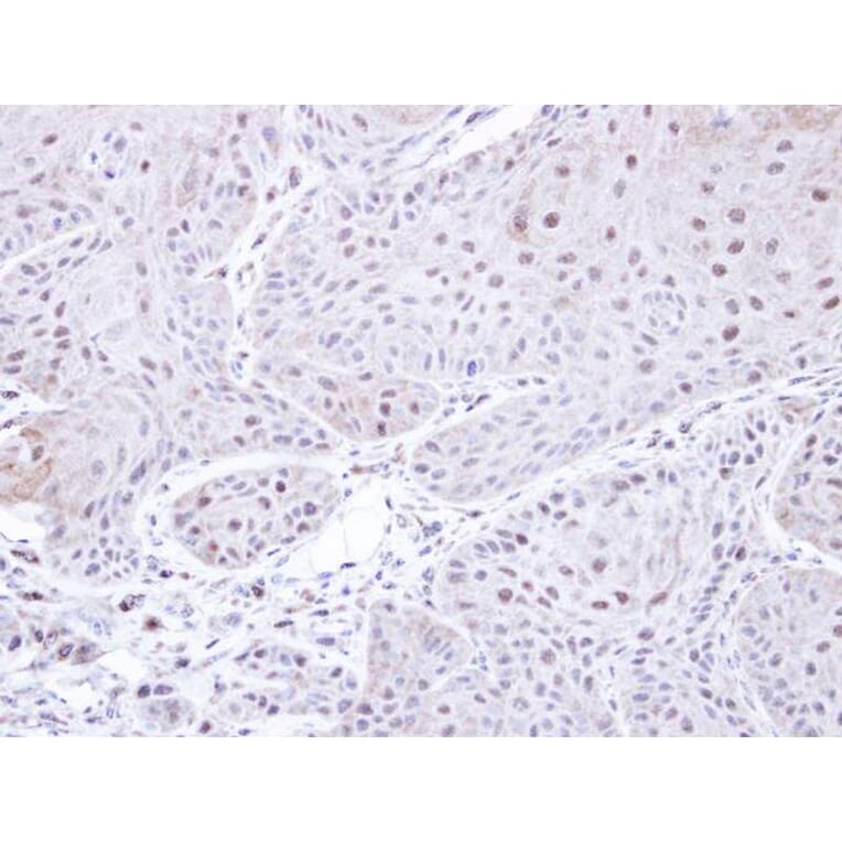 Immunohistochemistry - PSMC3 antibody from Signalway Antibody (22558) - Antibodies.com