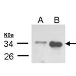TRADD antibody from Signalway Antibody (22562) - Antibodies.com