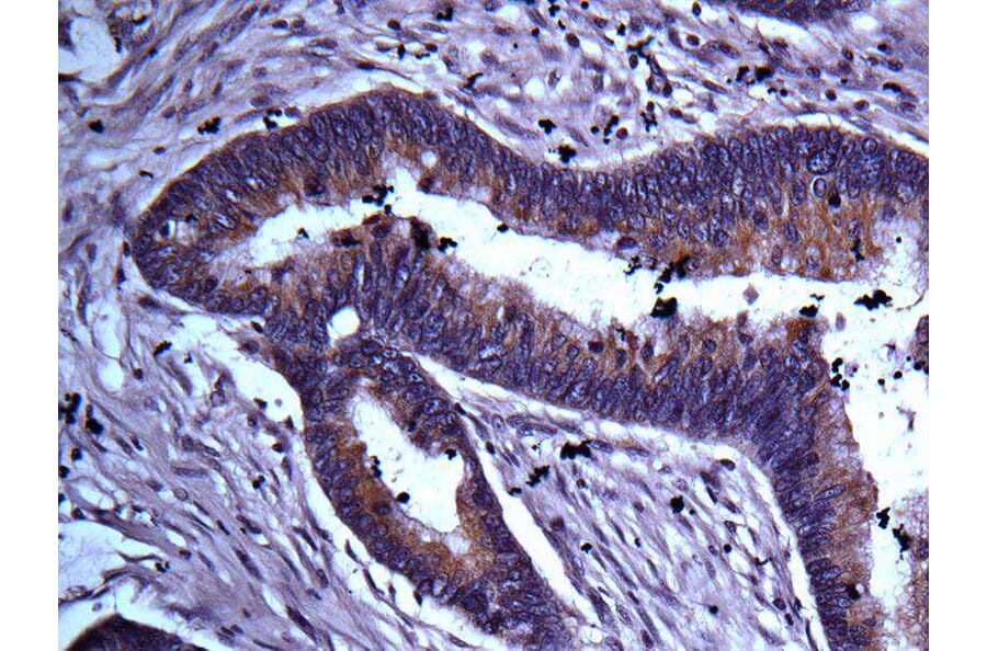Immunohistochemistry - TRADD antibody from Signalway Antibody (22562) - Antibodies.com