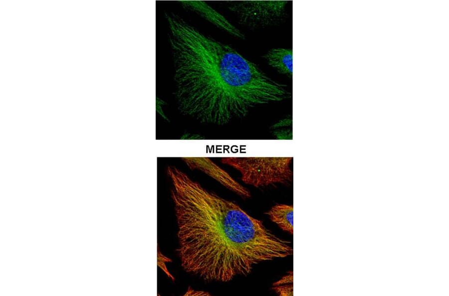 TRADD antibody from Signalway Antibody (22562) - Antibodies.com