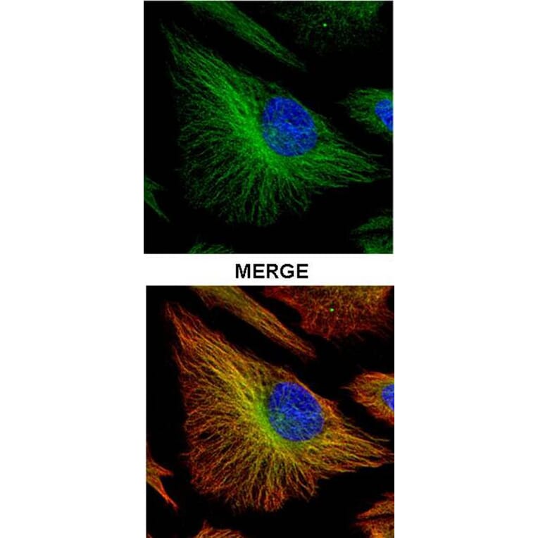 TRADD antibody from Signalway Antibody (22562) - Antibodies.com