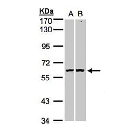 PARP3 antibody from Signalway Antibody (22567) - Antibodies.com