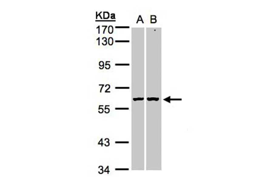 PARP3 antibody from Signalway Antibody (22567) - Antibodies.com