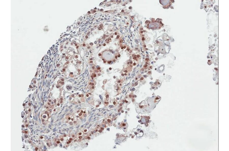 Immunohistochemistry - PARP3 antibody from Signalway Antibody (22567) - Antibodies.com