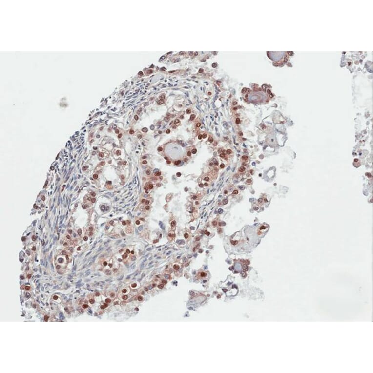 Immunohistochemistry - PARP3 antibody from Signalway Antibody (22567) - Antibodies.com