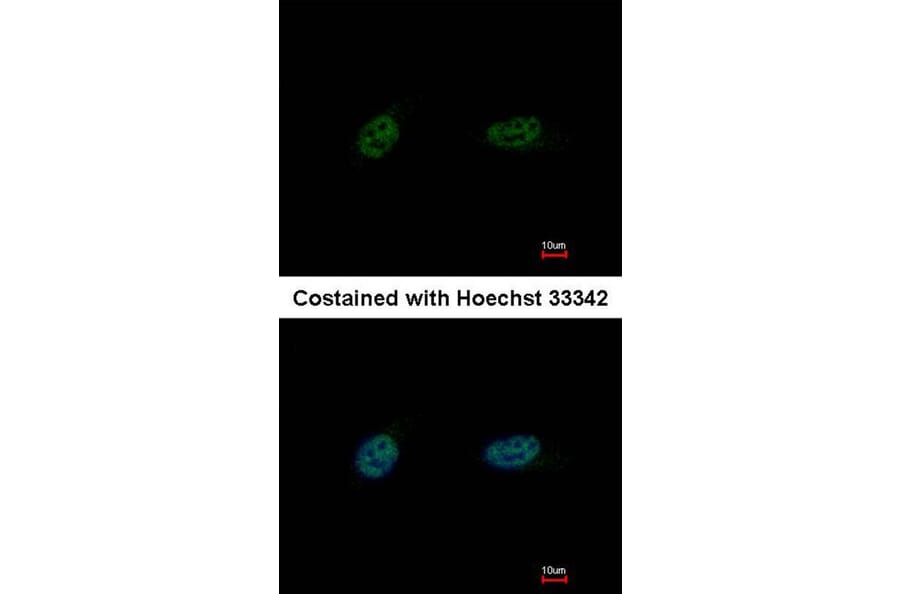 Immunofluorescence - PARP3 antibody from Signalway Antibody (22567) - Antibodies.com