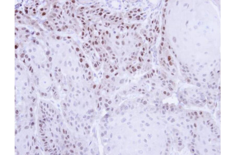 Immunohistochemistry - CSE1L antibody from Signalway Antibody (22574) - Antibodies.com