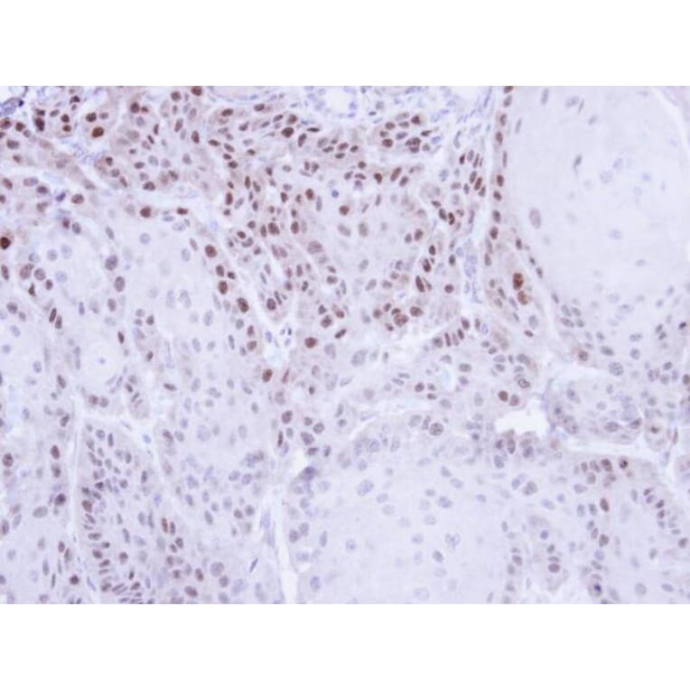 Immunohistochemistry - CSE1L antibody from Signalway Antibody (22574) - Antibodies.com