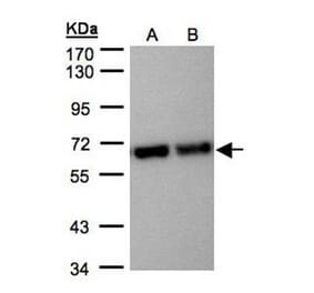 STIP1 antibody from Signalway Antibody (22582) - Antibodies.com