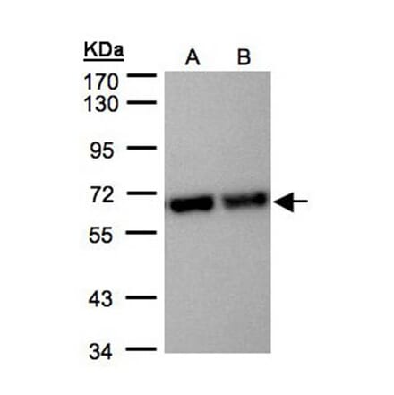 STIP1 antibody from Signalway Antibody (22582) - Antibodies.com