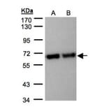 STIP1 antibody from Signalway Antibody (22582) - Antibodies.com