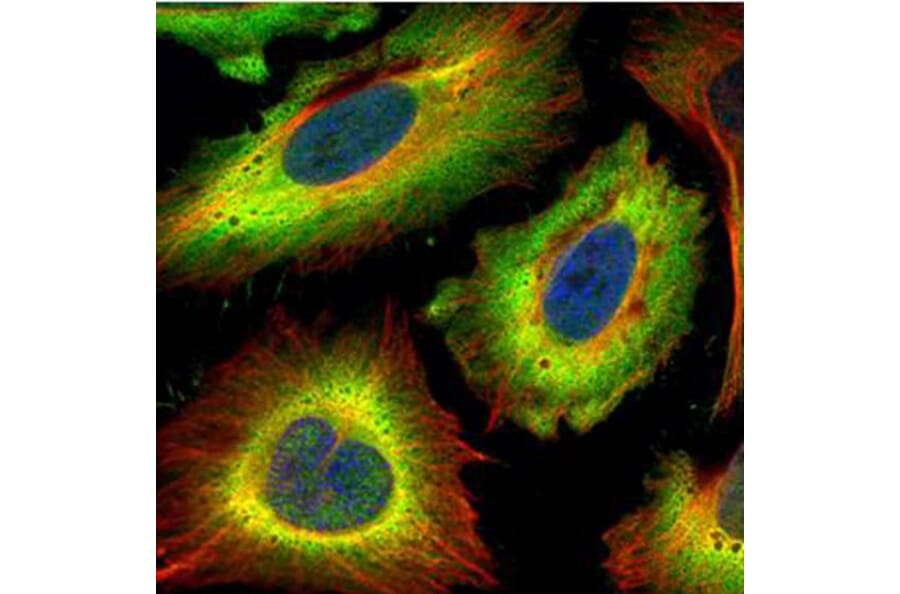 STIP1 antibody from Signalway Antibody (22582) - Antibodies.com