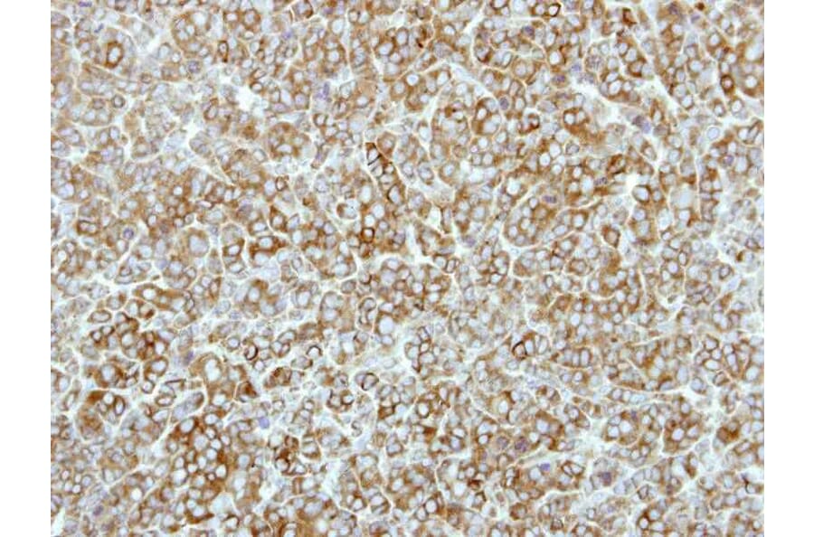Immunohistochemistry - EEF2K antibody from Signalway Antibody (22592) - Antibodies.com