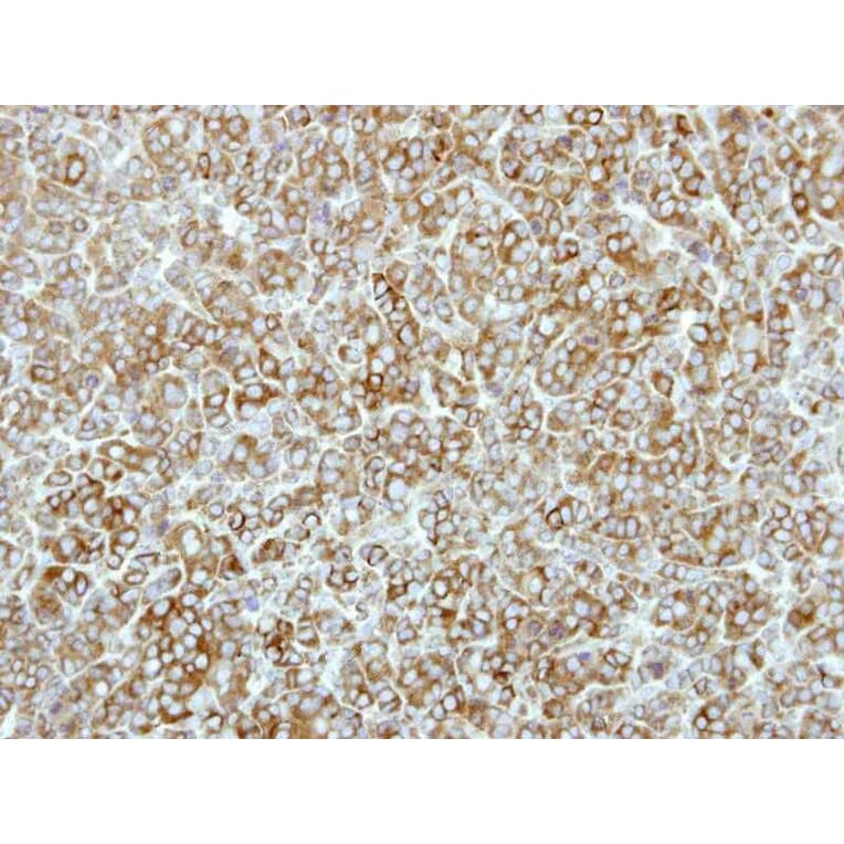 Immunohistochemistry - EEF2K antibody from Signalway Antibody (22592) - Antibodies.com