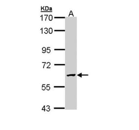 GALNS antibody from Signalway Antibody (22604) - Antibodies.com