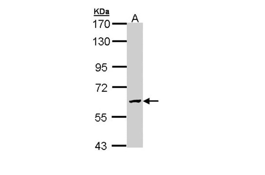 GALNS antibody from Signalway Antibody (22604) - Antibodies.com