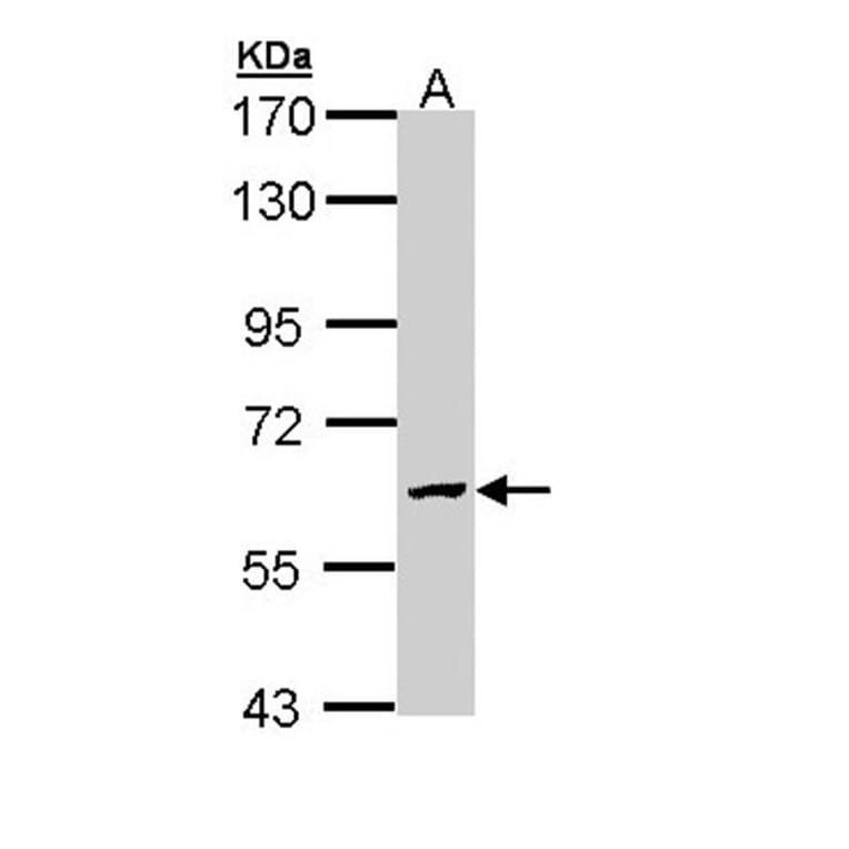 GALNS antibody from Signalway Antibody (22604) - Antibodies.com