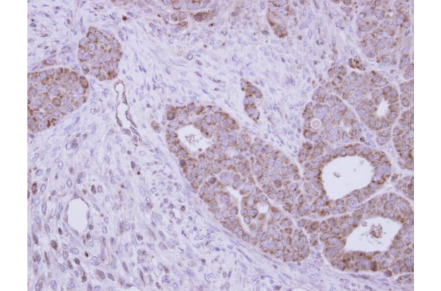 Immunohistochemistry - GALNS antibody from Signalway Antibody (22604) - Antibodies.com