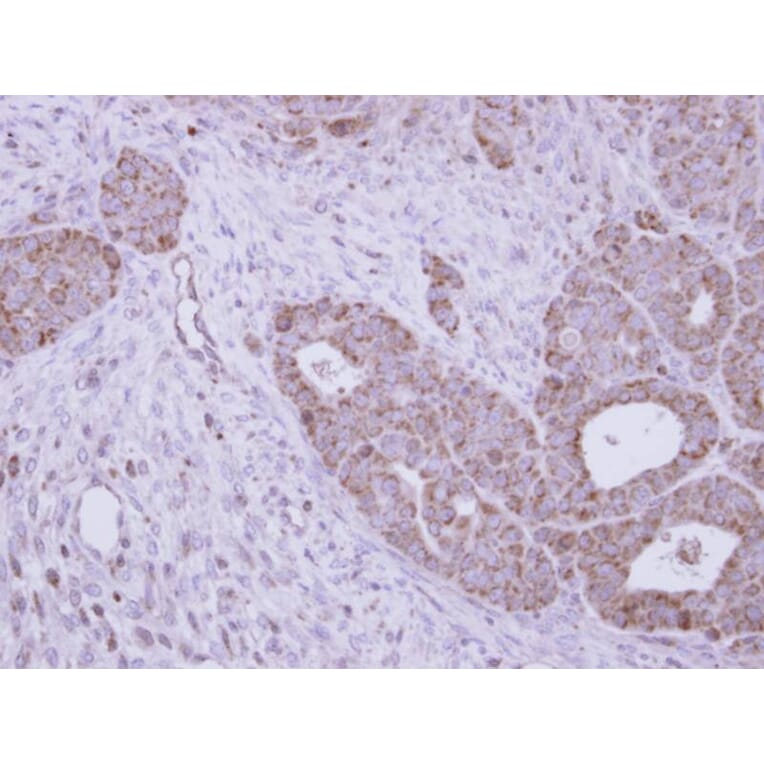 Immunohistochemistry - GALNS antibody from Signalway Antibody (22604) - Antibodies.com
