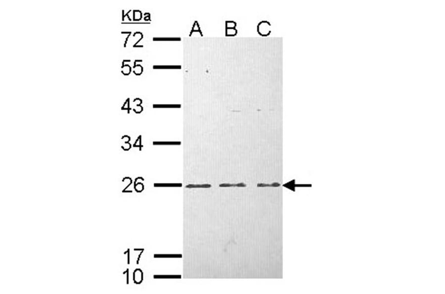 H-Ras antibody from Signalway Antibody (22615) - Antibodies.com
