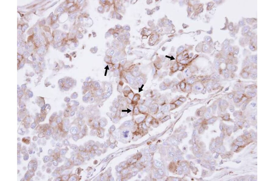 Immunohistochemistry - H-Ras antibody from Signalway Antibody (22615) - Antibodies.com