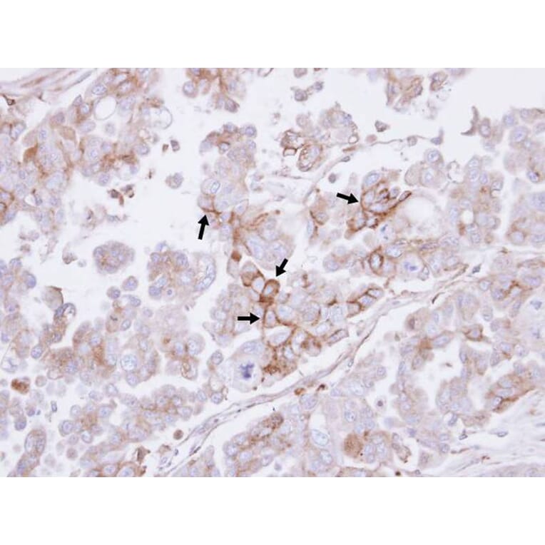 Immunohistochemistry - H-Ras antibody from Signalway Antibody (22615) - Antibodies.com