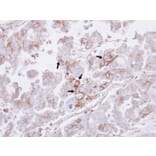 Immunohistochemistry - H-Ras antibody from Signalway Antibody (22615) - Antibodies.com