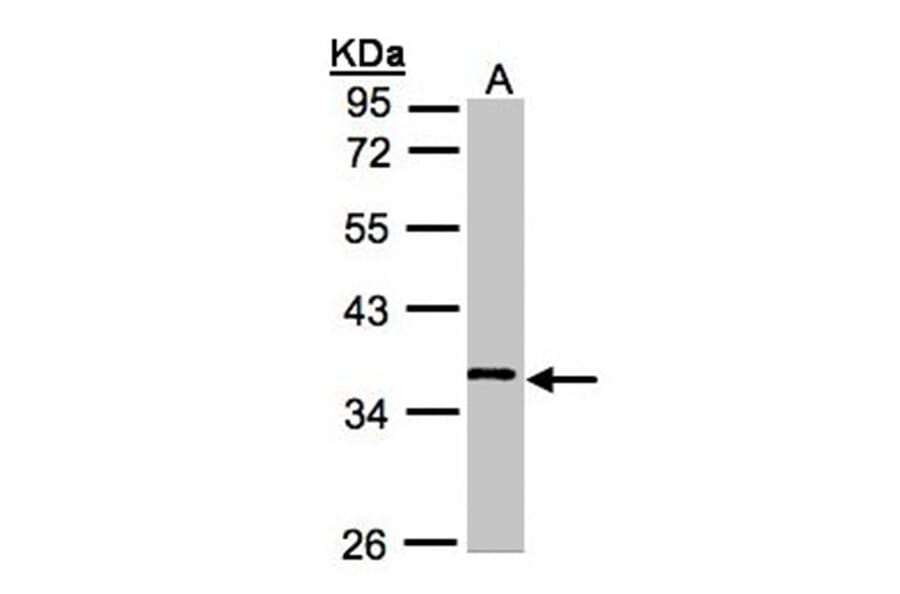 WNT11 antibody from Signalway Antibody (22624) - Antibodies.com