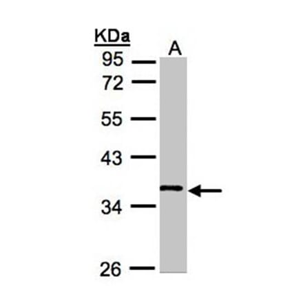 WNT11 antibody from Signalway Antibody (22624) - Antibodies.com