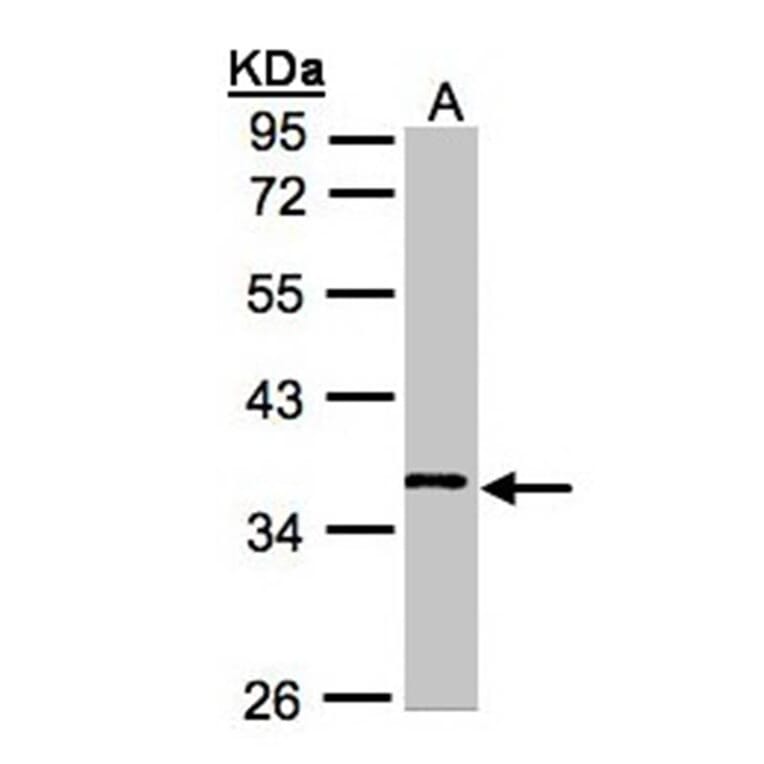 WNT11 antibody from Signalway Antibody (22624) - Antibodies.com