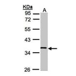 WNT11 antibody from Signalway Antibody (22624) - Antibodies.com