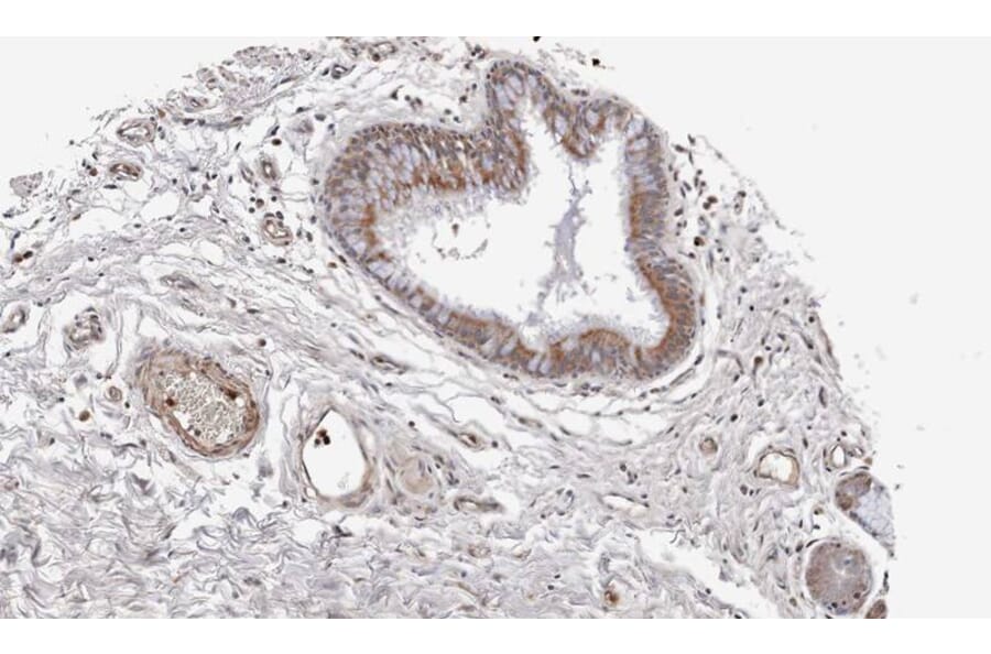 Immunohistochemistry - WNT11 antibody from Signalway Antibody (22624) - Antibodies.com