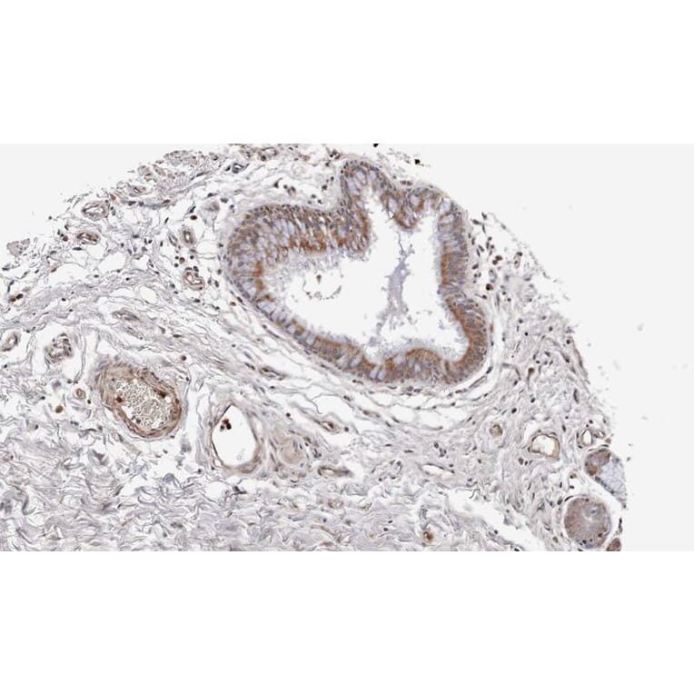 Immunohistochemistry - WNT11 antibody from Signalway Antibody (22624) - Antibodies.com