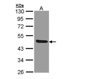IL1R2 antibody from Signalway Antibody (22661) - Antibodies.com