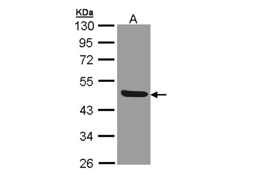 IL1R2 antibody from Signalway Antibody (22661) - Antibodies.com