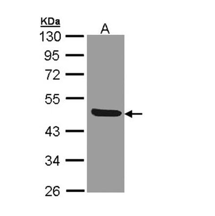 IL1R2 antibody from Signalway Antibody (22661) - Antibodies.com