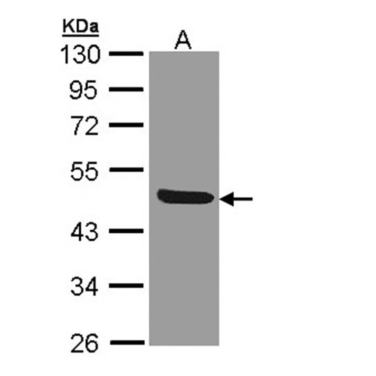 IL1R2 antibody from Signalway Antibody (22661) - Antibodies.com