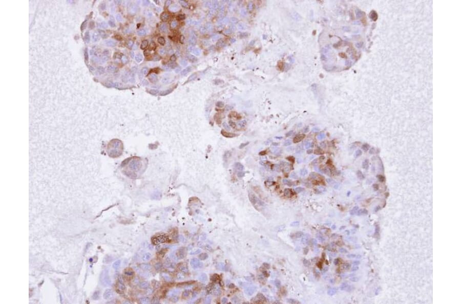 Immunohistochemistry - IL1R2 antibody from Signalway Antibody (22661) - Antibodies.com