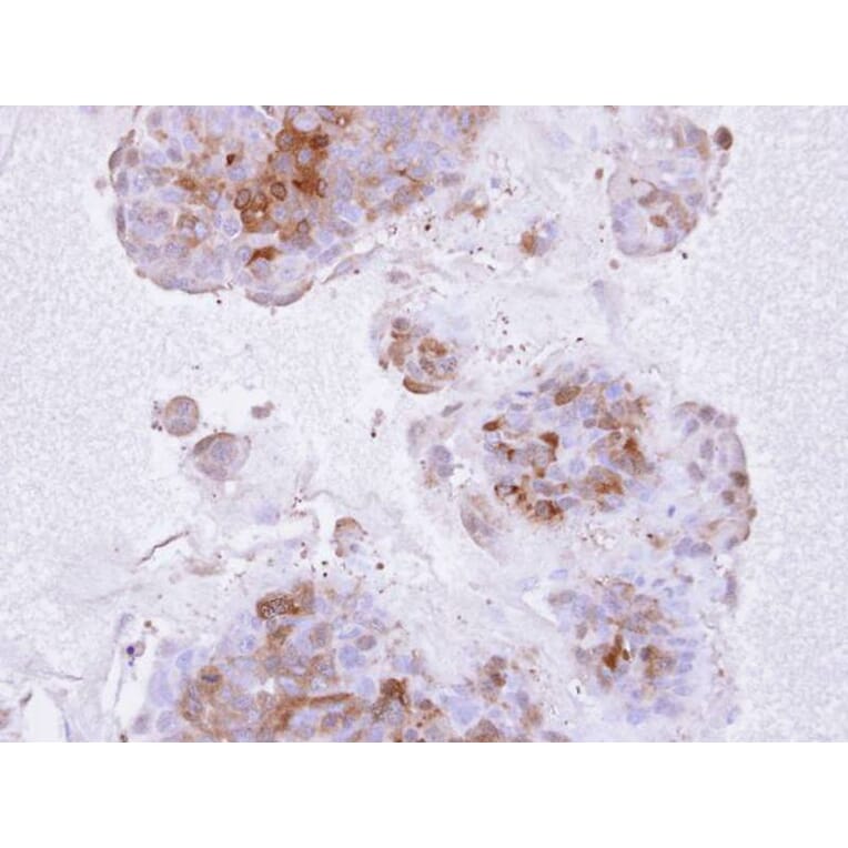 Immunohistochemistry - IL1R2 antibody from Signalway Antibody (22661) - Antibodies.com
