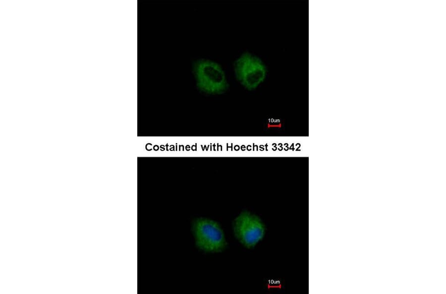Immunofluorescence - IL1R2 antibody from Signalway Antibody (22661) - Antibodies.com