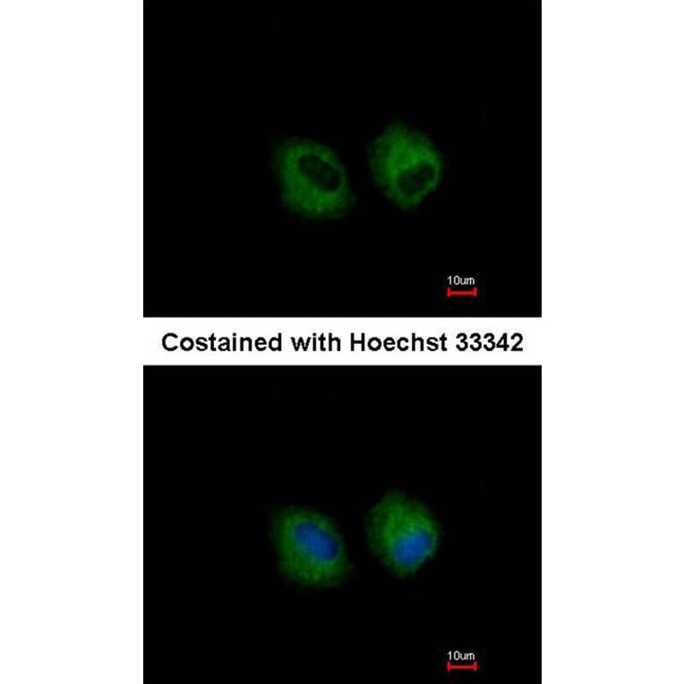 Immunofluorescence - IL1R2 antibody from Signalway Antibody (22661) - Antibodies.com