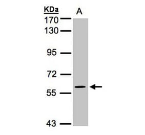 MAPK4 antibody from Signalway Antibody (22676) - Antibodies.com