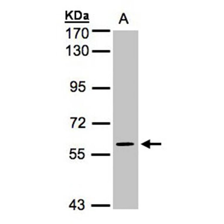 MAPK4 antibody from Signalway Antibody (22676) - Antibodies.com