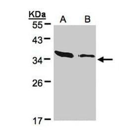 ARPC2 antibody from Signalway Antibody (22686) - Antibodies.com
