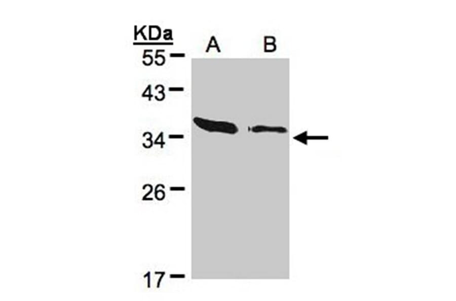 ARPC2 antibody from Signalway Antibody (22686) - Antibodies.com