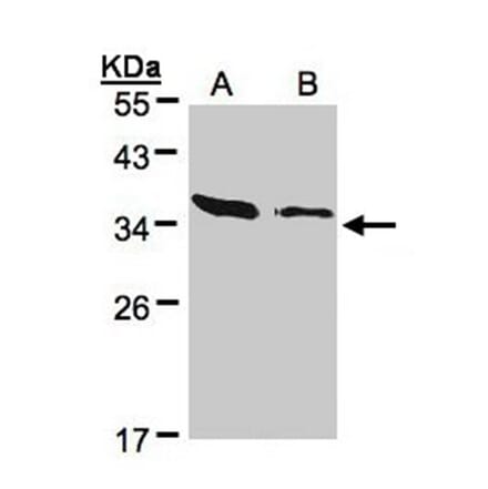 ARPC2 antibody from Signalway Antibody (22686) - Antibodies.com