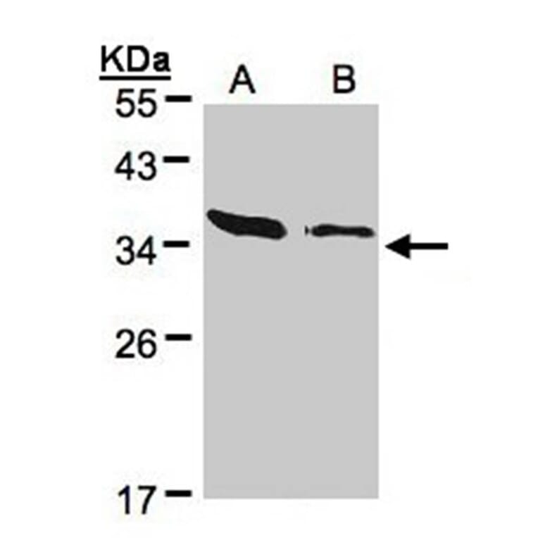 ARPC2 antibody from Signalway Antibody (22686) - Antibodies.com