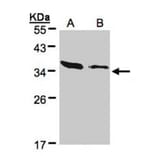 ARPC2 antibody from Signalway Antibody (22686) - Antibodies.com