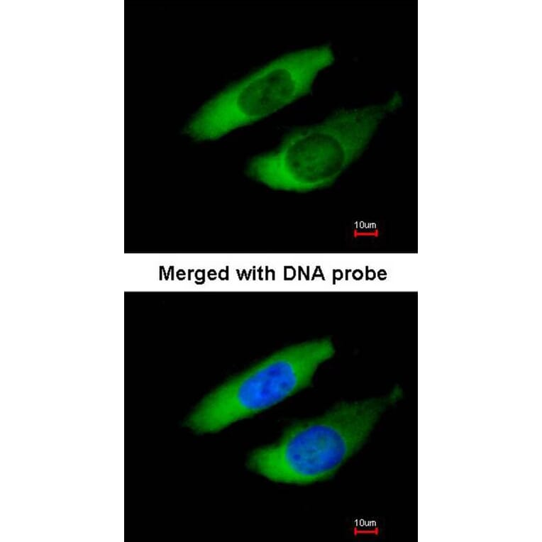 Immunofluorescence - ARPC2 antibody from Signalway Antibody (22686) - Antibodies.com