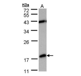 PDE6D antibody from Signalway Antibody (22703) - Antibodies.com